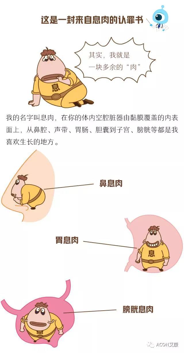 “艾”漫畫(huà) | 這是一封來(lái)自息肉的《認(rèn)罪書(shū)》