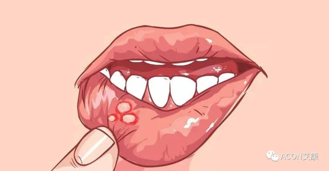 哪些小病容易讓人忽視，最后造成越拖越嚴(yán)重呢？