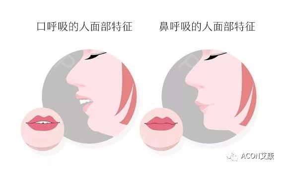 過敏性鼻炎會(huì)讓孩子變傻？！家長該如何應(yīng)對(duì)